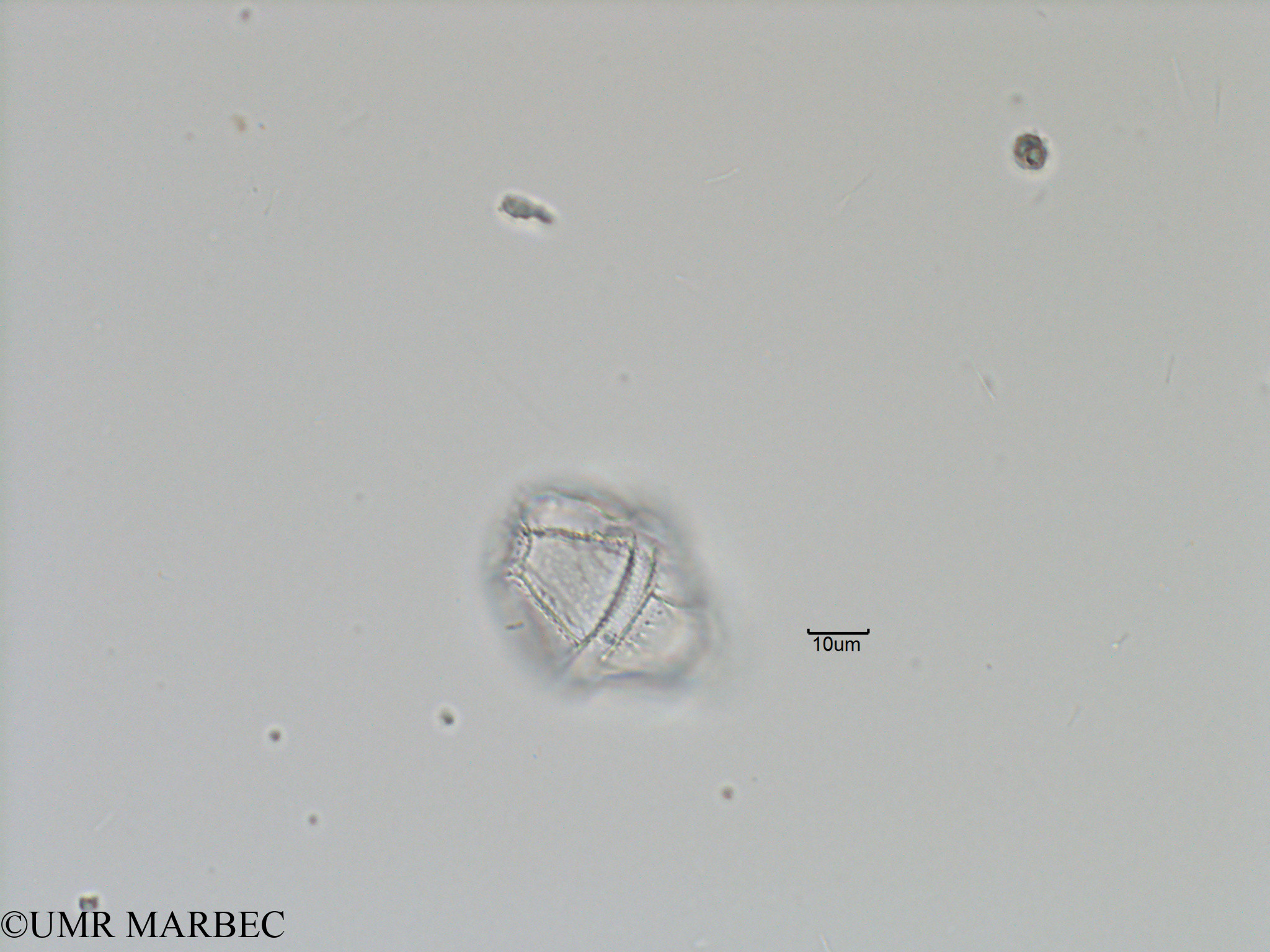 phyto/Bizerte/bizerte_bay/RISCO November 2015/Gonyaulax sp11 (Baie_T5-C2-Gonyaulax cf spinifera-3).tif(copy).jpg
